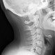 chiropractic cervical spine x-ray